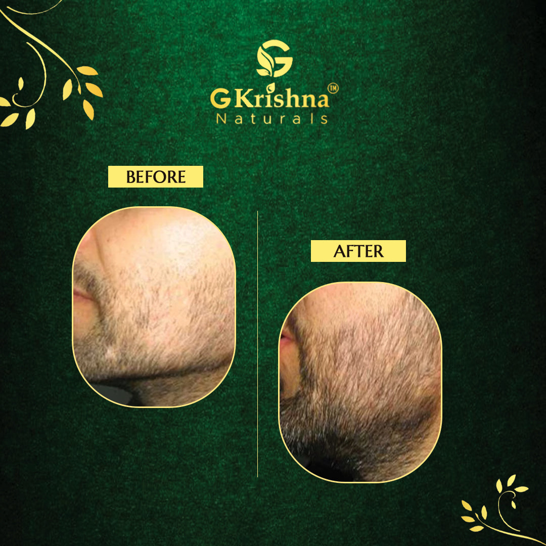 G Krishna Naturals Beard Growth Oil For Men
