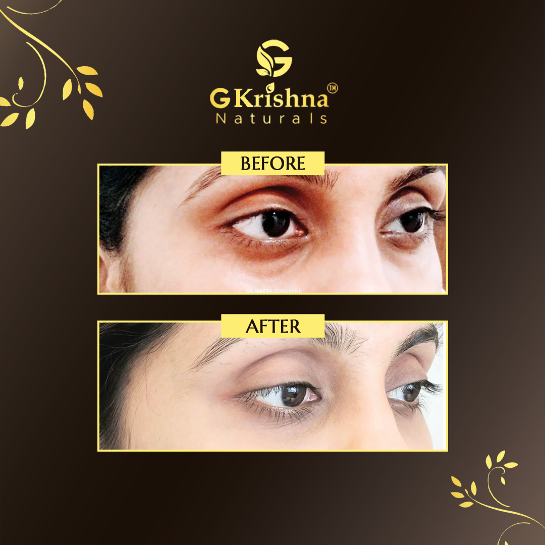 G Krishna Naturals Under Eye Gel for Dark Circles